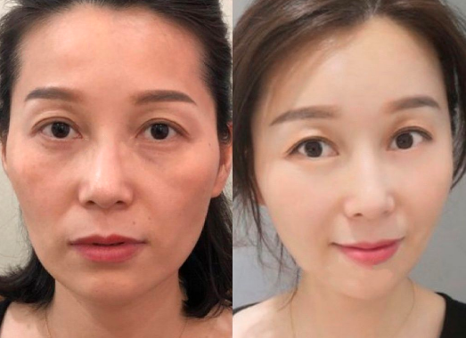 西安许龙顺做微拉美技术怎么样?